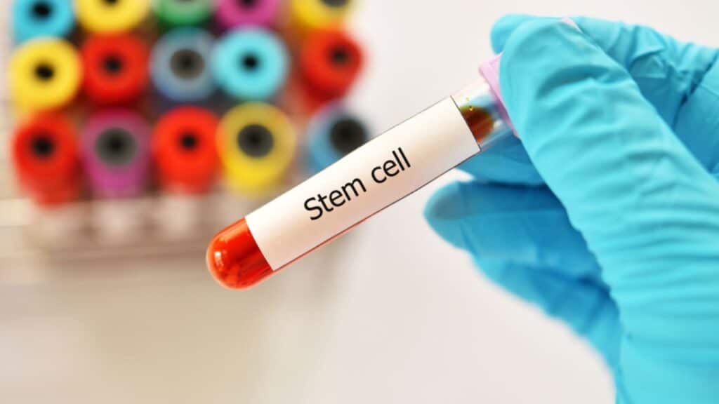 PRP vs Stem Cell Therapy Understanding the Key Differences PRP Treatment