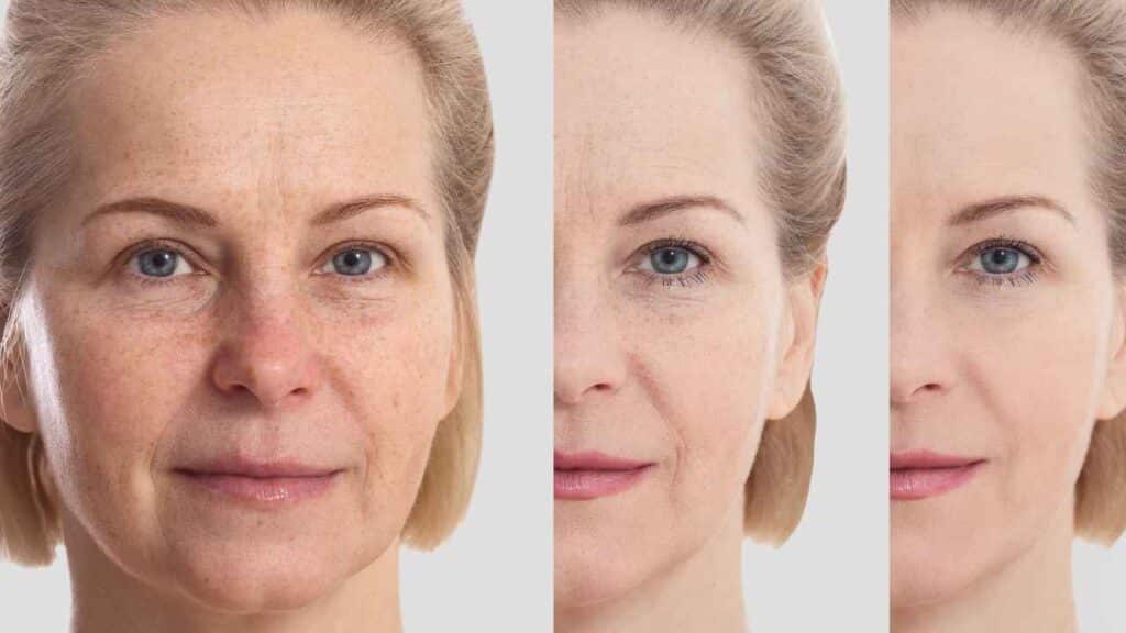 Crisp How Long After Microneedling Can I Wear Makeup Wallpaper for Your Screen Crisp How Long After Microneedling Can I Wear Makeup Wallpaper for Your Screen