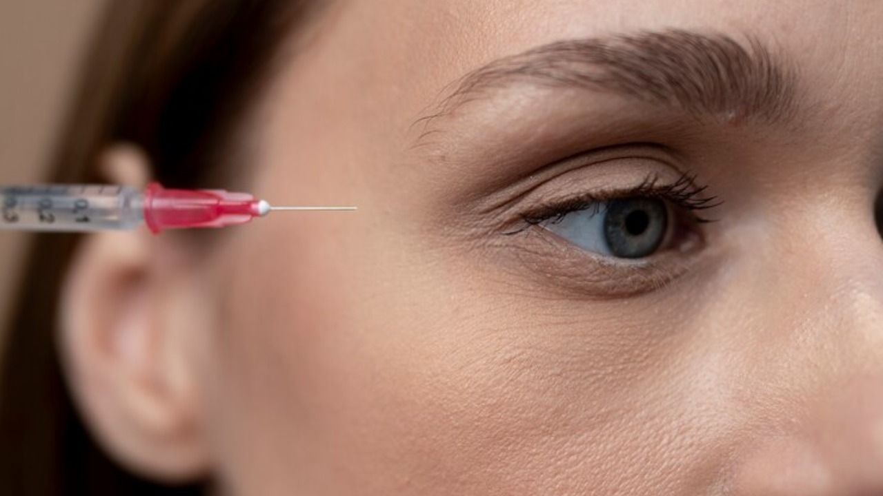 PRP Under Eyes Before And After Queries - FAQs Answered - PRP Treatment