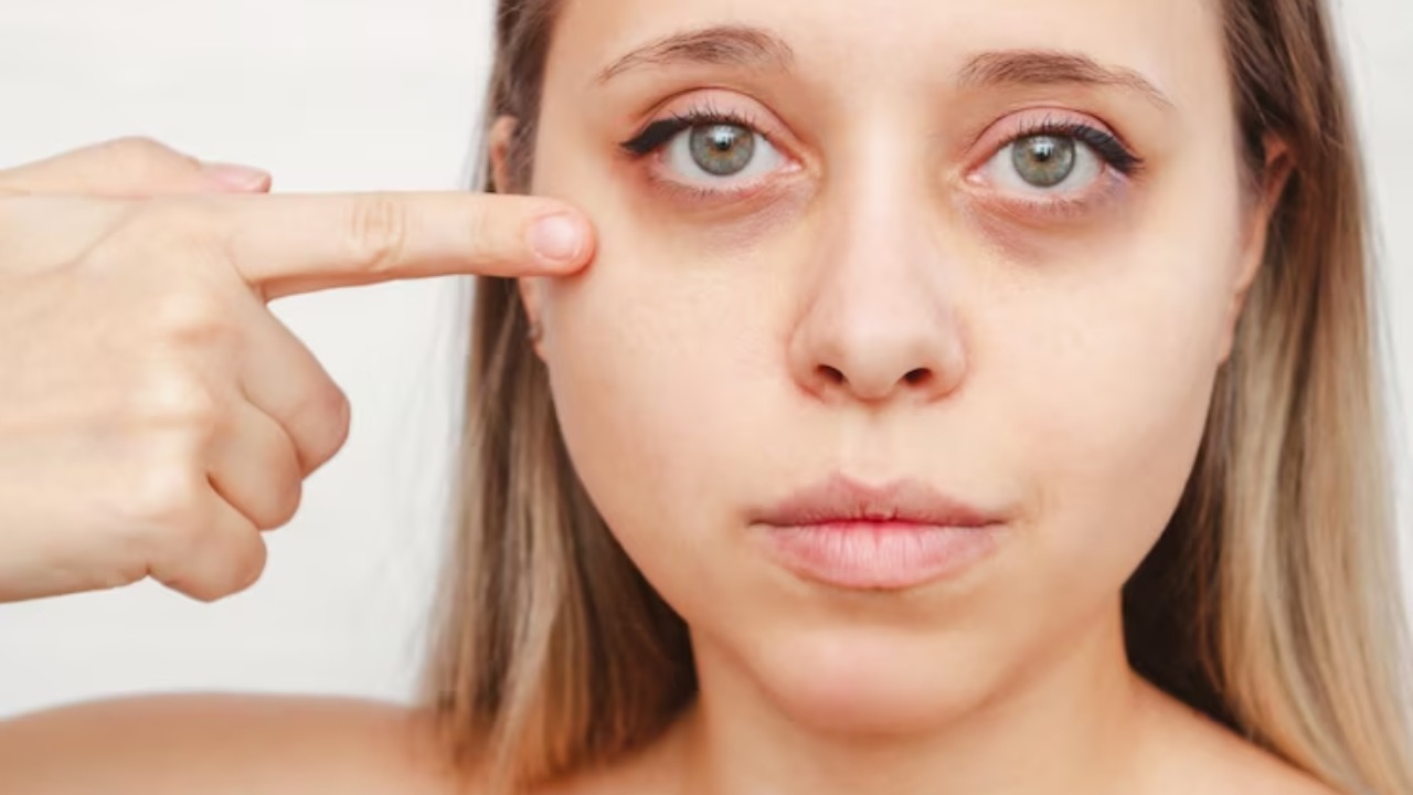 The Science Behind PRP for Dark Circles - How Does it Work - PRP Treatment