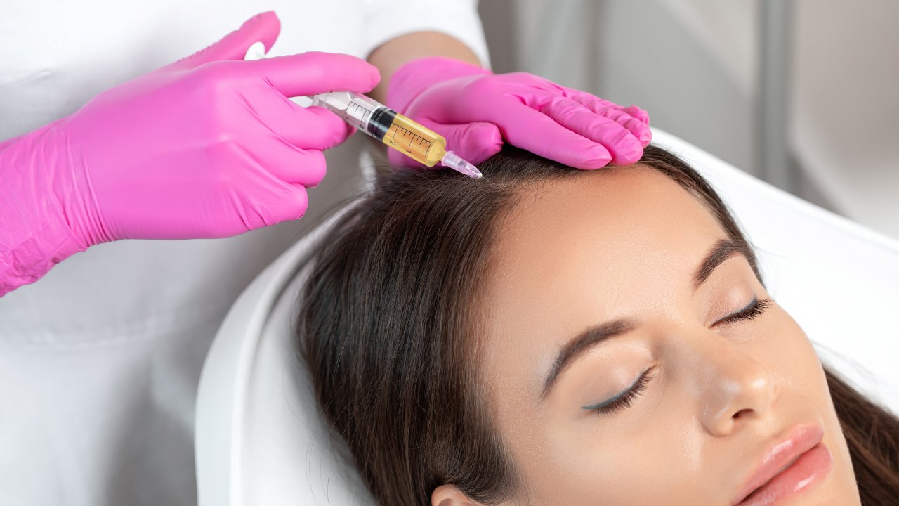 Is PRP Hair Loss Treatment Covered by Insurance? What You Need to Know
