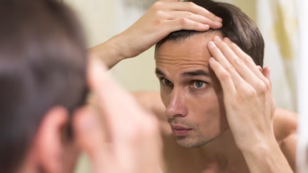 Understanding Hairloss Does Alopecia Go Away On Its Own - PRP Treatment