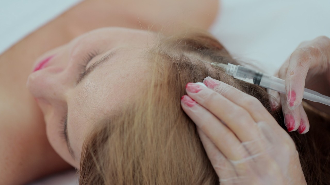 Scalp Injections for Hair Growth Cost - PRP Treatment