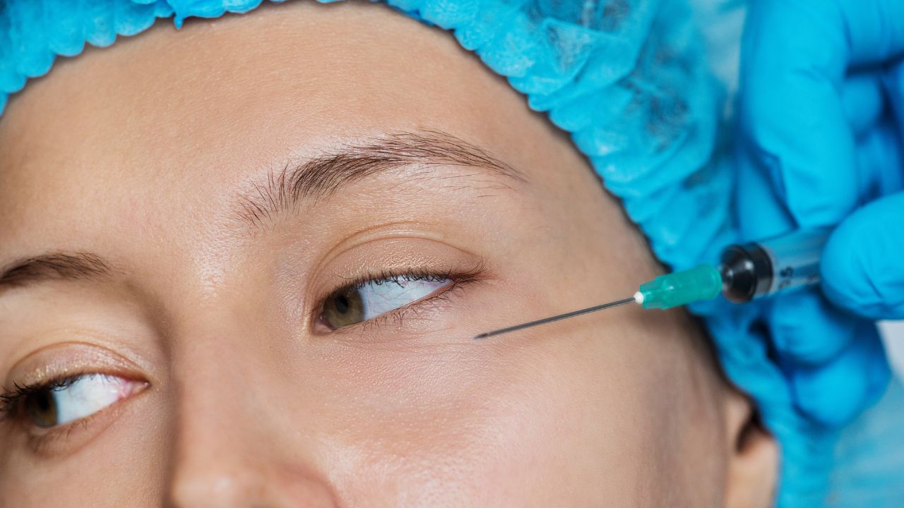 PRP vs PRF for Under-Eye