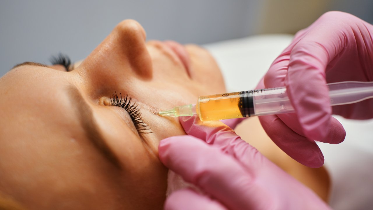 PRP vs PRF for Under-Eye